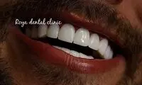 قیمت کامپوزیت دندان در سال 1404 (پرداخت اقساطی هزینه)