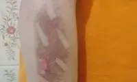 عکس‌هایی از شکنجه کودکان با اتو در این موسسه