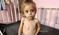 وضعیت وخیم «سندریلا غزه»