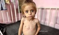 وضعیت وخیم «سندریلا غزه»