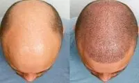 چگونه بفهمید که آیا و چه زمانی قرار است طاس شوید؟!