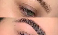 بررسی مراحل لیفت ابرو و مزایای آن