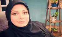 تغییر چهره مجری زن تلویزیون با جراحی‌ زیبایی!