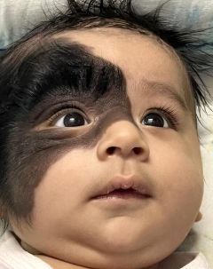 عکس هایی از تولد یک نوزاد با شمایلی باورنکردنی 
