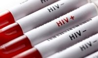 واقعیت انتقال HPV از استخر و سرویس بهداشتی