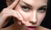 بلفاروپلاستی چشم گربه ای
