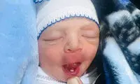 این نوزاد با چیزی غیرعادی به دنیا آمد!