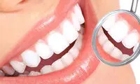 بهترین کلینیک کاشت دندان در شرق تهران- مراحل یک ایمپلنت دندانی