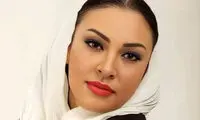 تغییر چهره عجیب زیبا بروفه خبرساز شد
