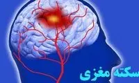 علائم سکته مغزی چیست؟