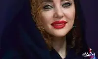 تغییر چهره شدید بازیگر زن سینما در کنار دارا حیایی