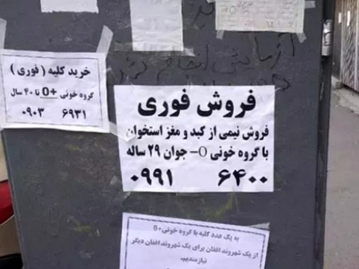   نقل قول «کلیه فروشی» از طرف یک نماینده دوباره جنجالی شد 