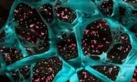 ابداعی که می‌تواند از پیشروی سرطان جلوگیری کند