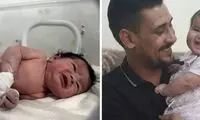 دختر معجزه شش ماهه شد