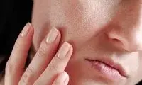 ۱۱ روش مؤثر برای از بین بردن جای جوش