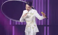چهره جوان ابرو گوندش بعد از عمل زیبایی