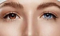 چه زمانی عمل تغییر رنگ چشم جنبه درمانی دارد؟