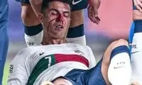 رونالدو هم پنالتی داد، هم خونین و مالین شد!