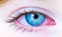 چگونه علائم بیماری کاوازاکی را تشخیص دهیم؟