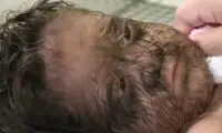 تصاویری از دختر دو ساله با صورت پر از مو