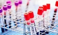 حذف ویروس HIV از سلول‌های آلوده با یک ژن بَرنده