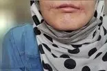 مرد مشهدی لب‌های زن ۱۸ ساله‌اش را دوخت