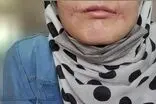 مرد مشهدی لب‌های زن ۱۸ ساله‌اش را دوخت