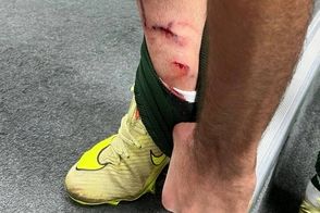 این سه صحنه داوری صدای پرسپولیس و حریفش را درآورد