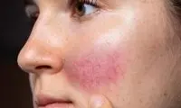 چه عواملی باعث خشکی پوست می‌شود؟