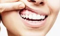 آزمایشی ۱۰ دقیقه‌ای برای تشخیص بیماری لثه در خانه
