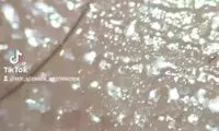 تصاویری از آشیانه میلیون‌ها میکروب خطرناک!
