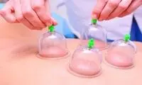 زمان مناسب برای انجام حجامت