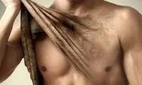 مرکز لیزر موی زائد ویژه اقایان در شمال تهران 