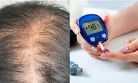 ارتباط دیابت با ریزش مو