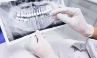 بهترین راه جلوگیری از خرابی دندان‌ها در اوضاع بد اقتصادی!