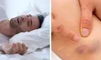 ۱۱ نشانه در بدن که نباید به آن‌ها بی‌اعتنا بود