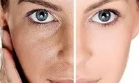 برای شادابی پوست این خوراکی‌ها را بخورید