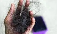 چرا موها در بارداری پرپشت می‌شوند و بعد از زایمان می‌ریزند؟
