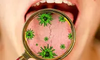 یک باکتری دهانی می‌تواند ام‌اس را شدیدتر کند!