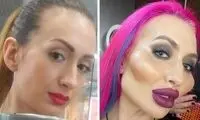 زنی با بزرگترین گونه دنیا