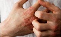 چطور بفهمیم سیستم ایمنی بدن ما ضعیف است یا قوی؟