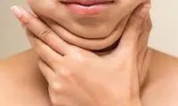 بهترین روش رفع غبغب | بررسی روش‌های بدون جراحی و با جراحی