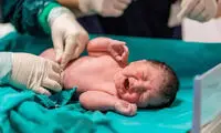لحظه معجزه‌آسای تلاش پزشک برای نجات نوزاد از مرگ