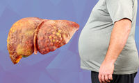 یک داروی ضد چاقی علیه کبد چرب