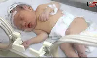 قطع نخاع نوزاد ۵ ماهه بر اثر شکستن قلنج! 