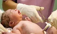 عکسی حیرت‌انگیز از یک بند ناف ایرانی