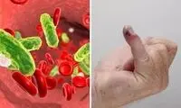 کدام بیماری هر ۳ ثانیه جان یک نفر را می‌گیرد؟