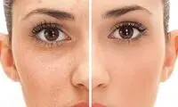 مواد غذایی که سلامت پوست را تضمین ‌می‌کند