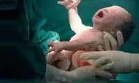 آمار زایمان‌های اورژانسی تهرانی‌ها در آمبولانس و خانه 