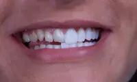 بهترین دندانپزشک زیبایی در تهران + لیست 10 دندانپزشک برتر